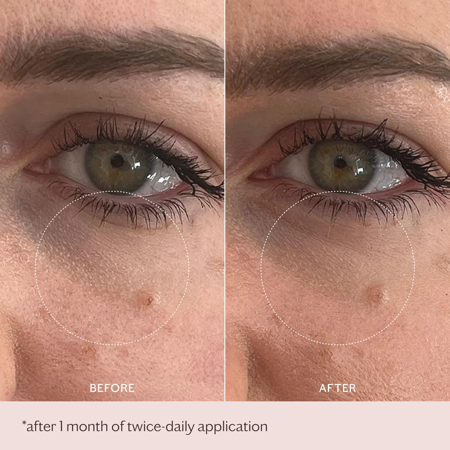 MZ Skin Intensive Bio-Placenta Eye Cream - Image 8