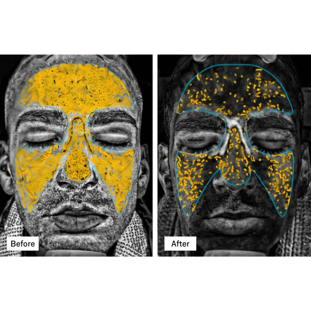 Omnilux Men LED Mask - Image 10