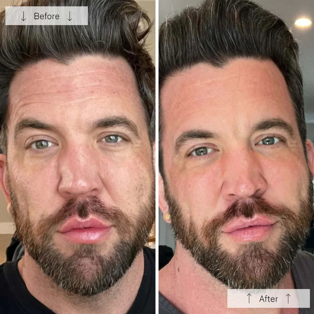 Omnilux Men LED Mask - Image 7