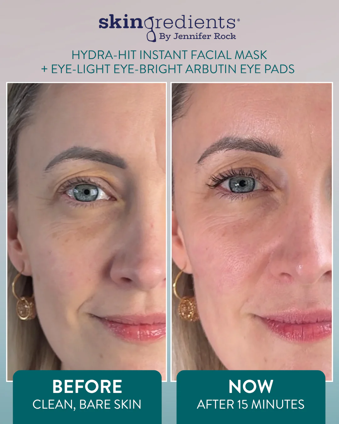 Skingredients Hydra-Hit Instant Facial Mask - Image 4