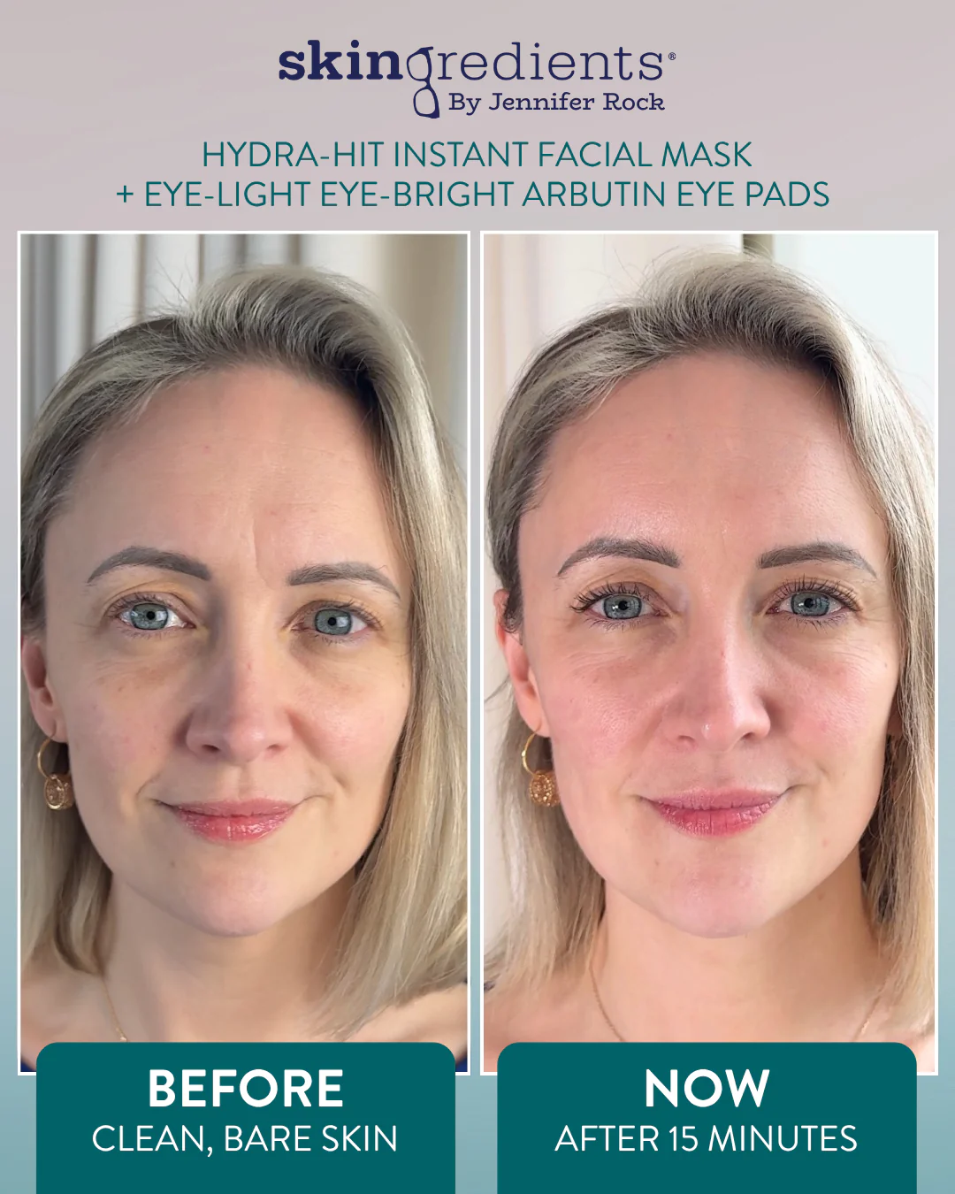 Skingredients Hydra-Hit Instant Facial Mask - Image 5
