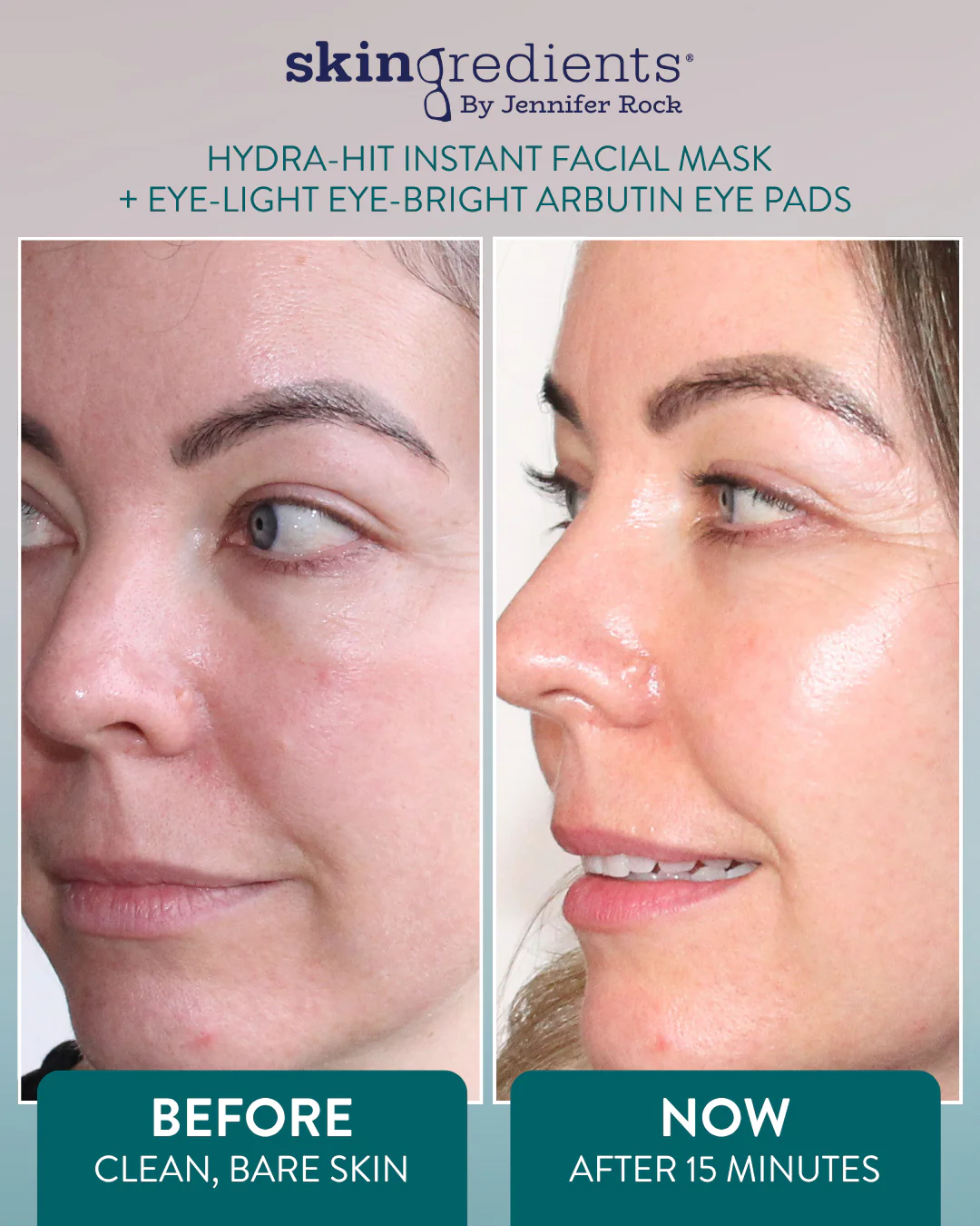 Skingredients Hydra-Hit Instant Facial Mask - Image 8