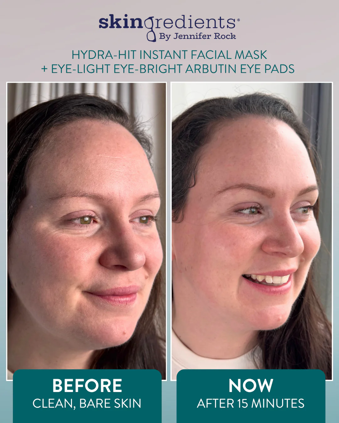 Skingredients Hydra-Hit Instant Facial Mask - Image 9