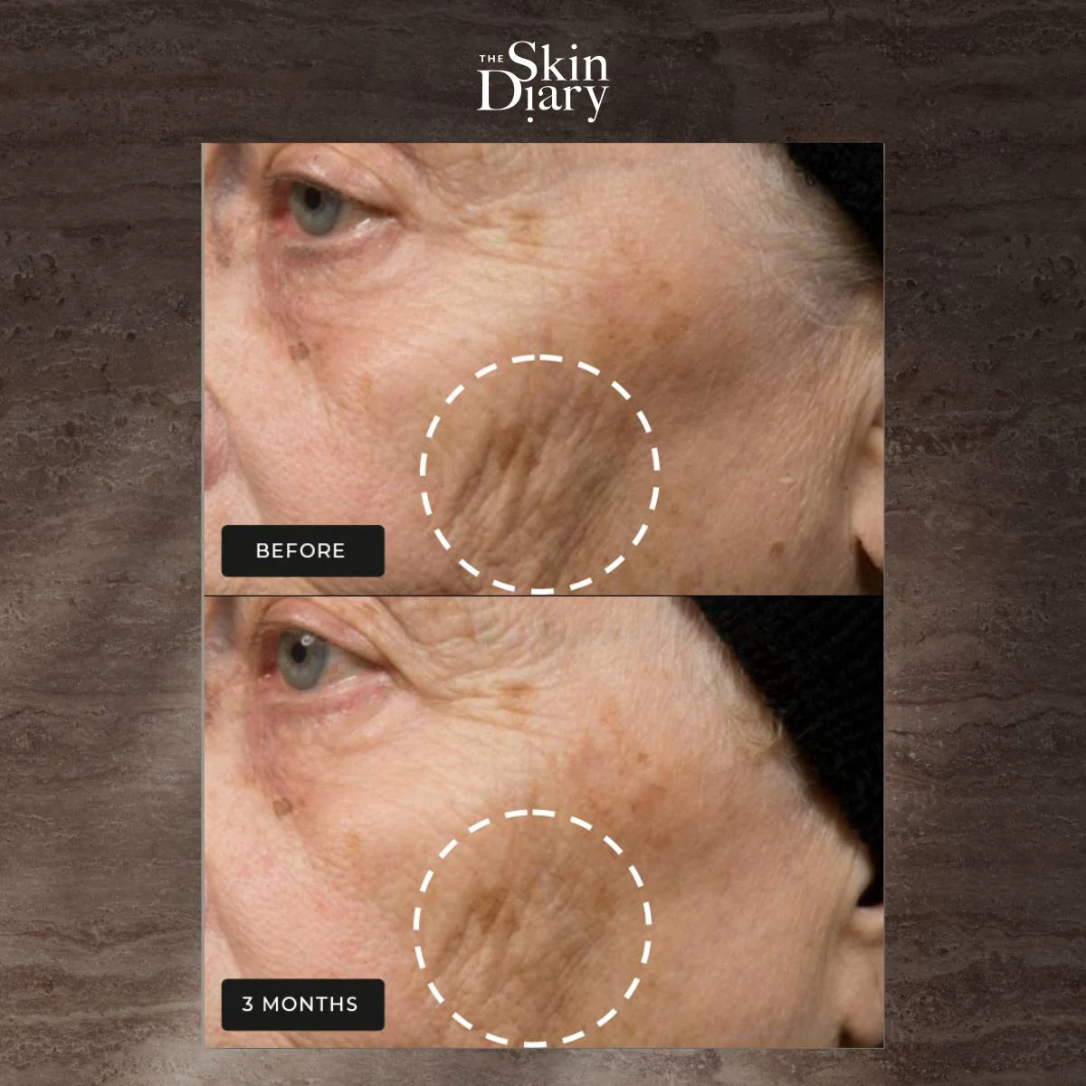 The Skin Diary Night Repair Therapy - Advanced Retinol Night Cream - Image 7