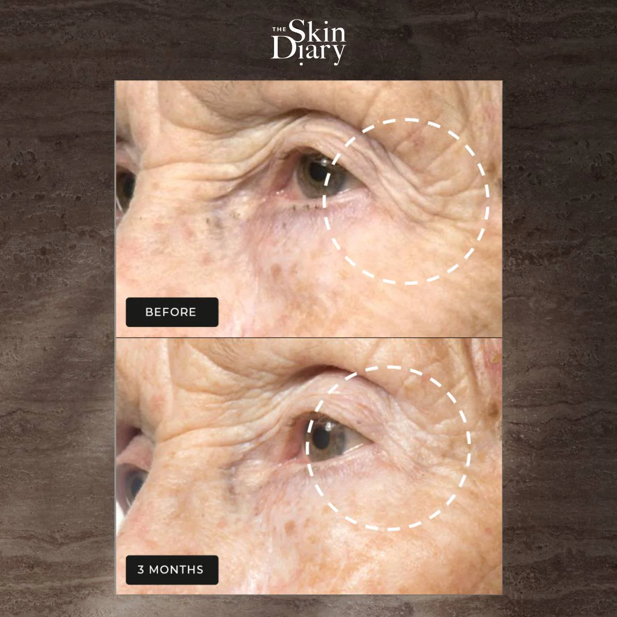 The Skin Diary Night Repair Therapy - Advanced Retinol Night Cream - Image 6